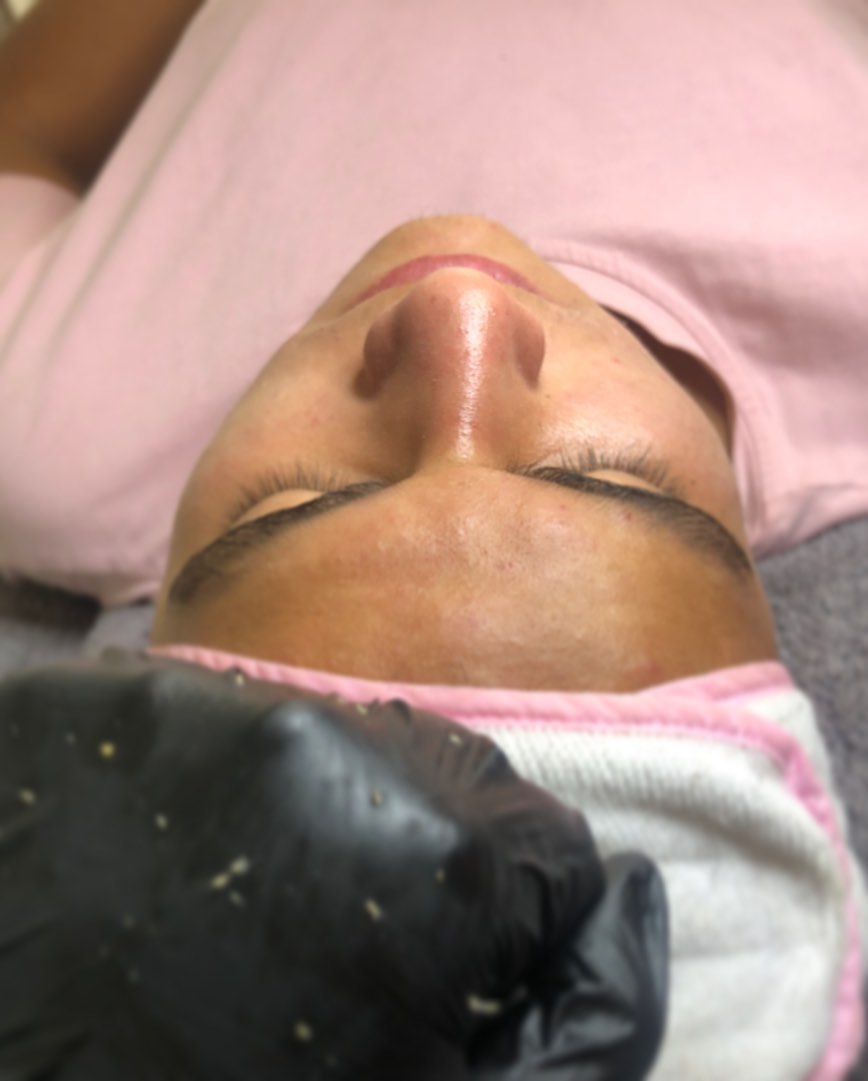 Tratamiento Hidrafacial y Limpieza en Orch Beauty